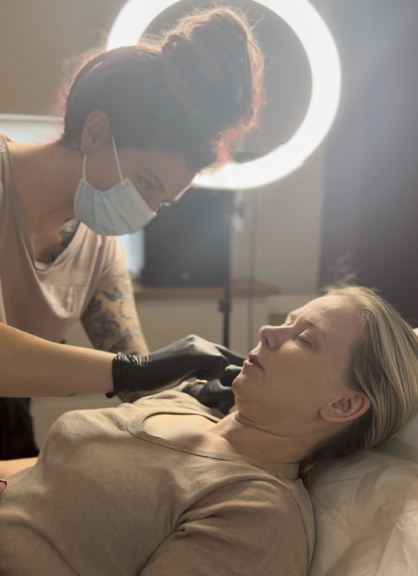 Lip filler treatment